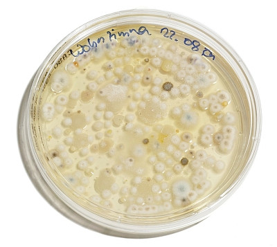 Labormäßige Schimmelanzucht aus Sporen (Befall Wohnzimmer)